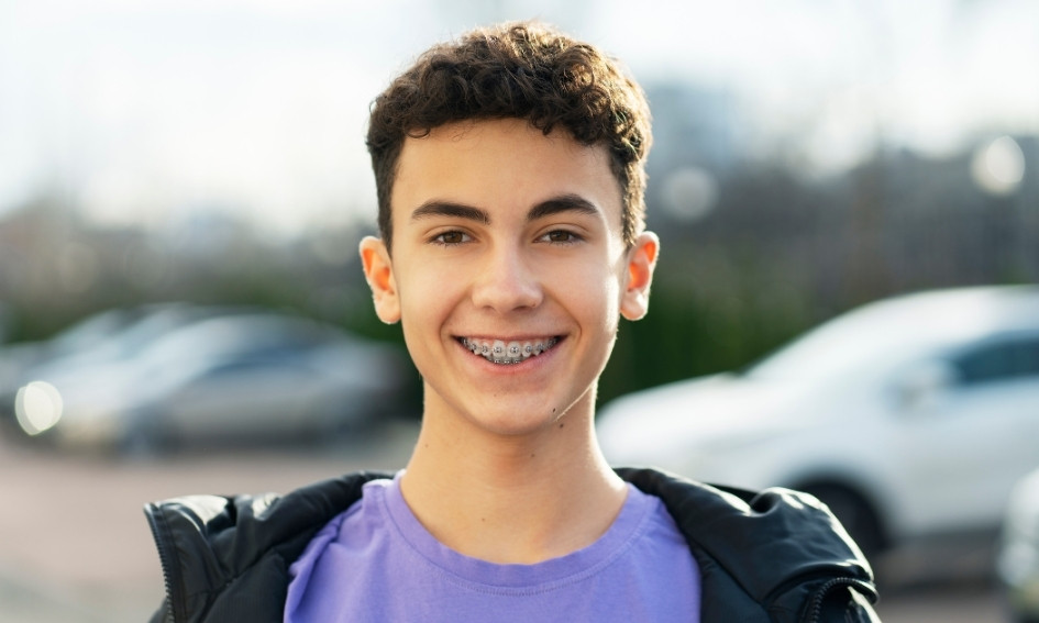 How Long Braces Take